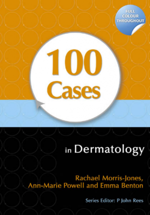 100 CASES in Dermatology